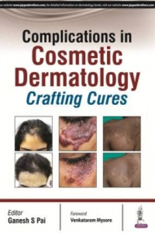 Könyv Complications in Cosmetic Dermatology Ganesh S. Pai