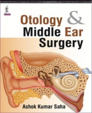 Carte Otology & Middle Ear Surgery Ashok Kumar Saha