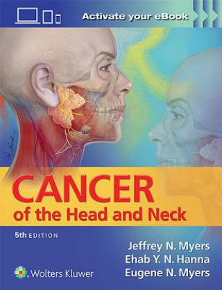 Carte Cancer of the Head and Neck Jeffrey Myers