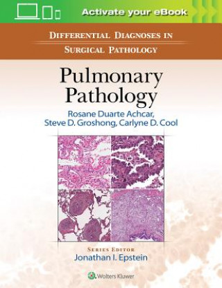 Carte Differential Diagnoses in Surgical Pathology: Pulmonary Pathology Rosane Duarte Achcar