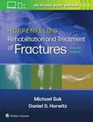 Carte Hoppenfeld's Treatment and Rehabilitation of Fractures Michael Suk