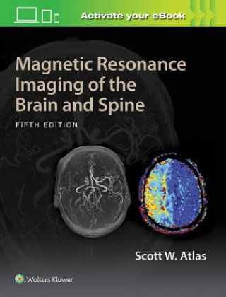 Kniha Magnetic Resonance Imaging of the Brain and Spine Atlas