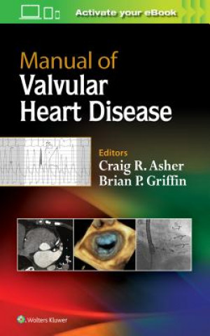Könyv Manual of Valvular Heart Disease Craig Asher