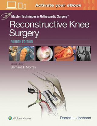 Carte Master Techniques in Orthopaedic Surgery: Reconstructive Knee Surgery Darren L. Johnson