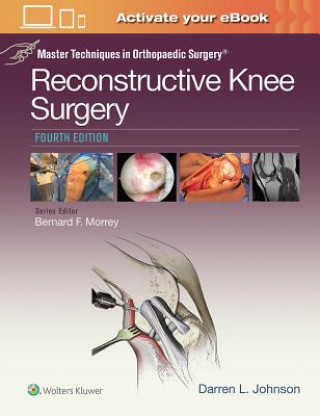 Książka Master Techniques in Orthopaedic Surgery: Reconstructive Knee Surgery Darren L. Johnson