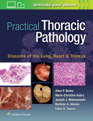 Libro Practical Thoracic Pathology Allen P. Burke