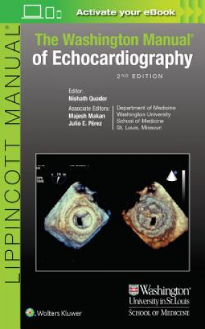 Kniha Washington Manual of Echocardiography Ravi Rasalingam