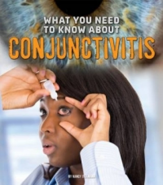 Kniha What You Need to Know about Conjunctivitis Nancy Dickmann