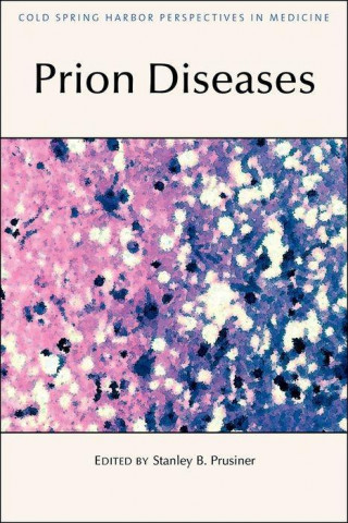 Kniha Prion Diseases 