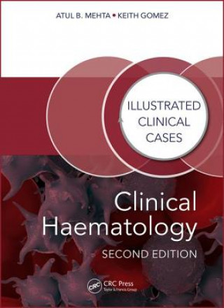 Kniha Clinical Haematology Atul Bhanu Mehta