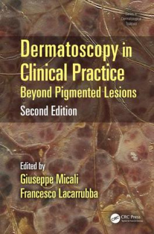 Knjiga Dermatoscopy in Clinical Practice 