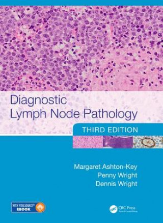 Könyv Diagnostic Lymph Node Pathology Margaret Ashton-Key