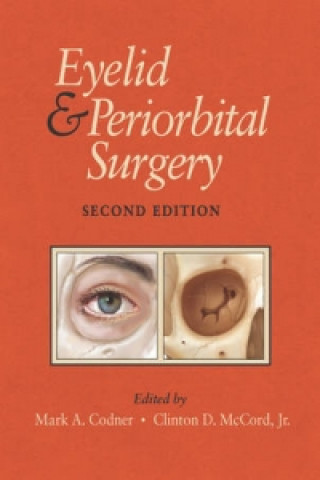 Kniha Eyelid and Periorbital Surgery 