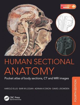 Книга Human Sectional Anatomy David J. Bowden