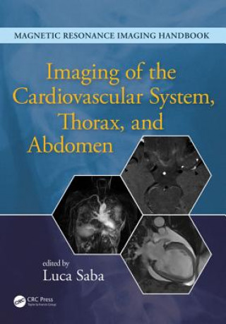 Carte Imaging of the Cardiovascular System, Thorax, and Abdomen 