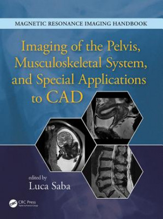 Könyv Imaging of the Pelvis, Musculoskeletal System, and Special Applications to CAD Luca Saba