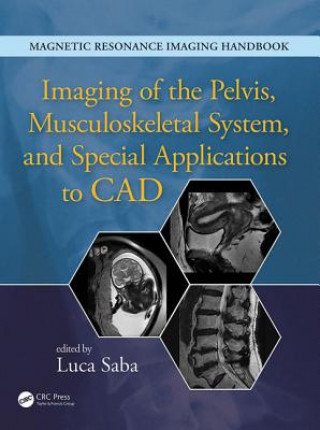 Książka Imaging of the Pelvis, Musculoskeletal System, and Special Applications to CAD Luca Saba