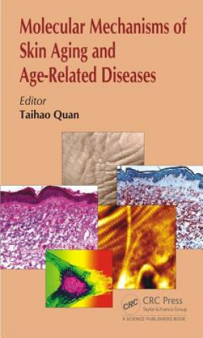 Kniha Molecular Mechanisms of Skin Aging and Age-Related Diseases Taihao Quan