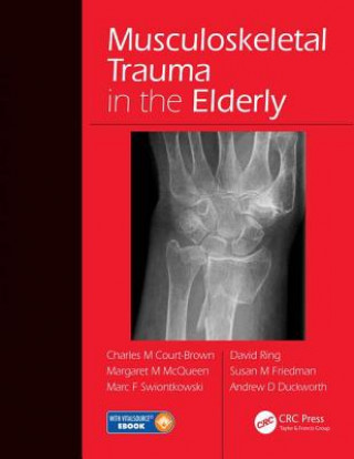 Kniha Musculoskeletal Trauma in the Elderly 