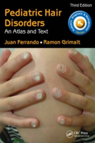 Buch Pediatric Hair Disorders Juan Ferrando