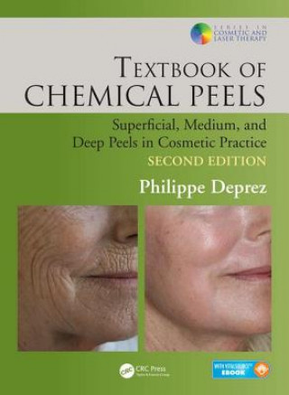 Książka Textbook of Chemical Peels Philippe Deprez