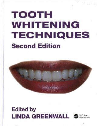 Kniha Tooth Whitening Techniques Linda Greenwall