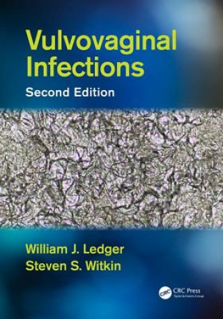 Kniha Vulvovaginal Infections William J. Ledger