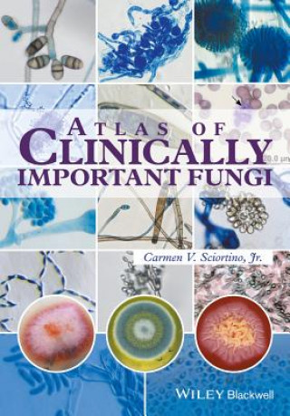 Könyv Atlas of Clinically Important Fungi Carmen Sciortino