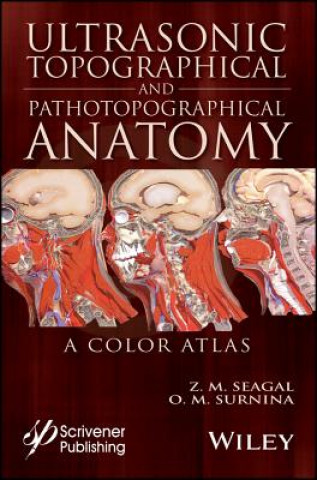Carte Ultrasonic Topographical and Pathotopographical Anatomy - A Color Atlas Zoltan M. Seagal
