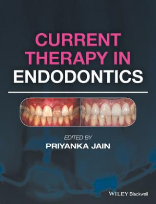 Kniha Current Therapy in Endodontics Priyanka Jain