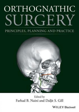 Carte Orthognathic Surgery - Principles, Planning and Practice Farhad B. Naini