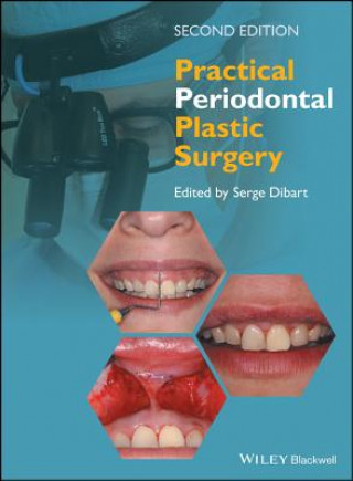 Kniha Practical Periodontal Plastic Surgery 2e Serge Dibart