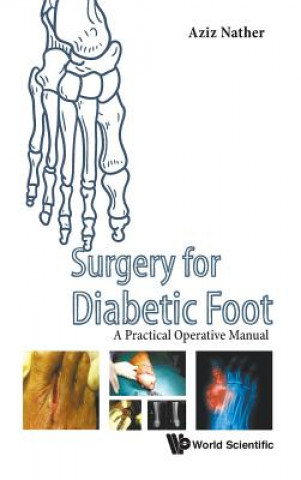 Könyv Surgery For Diabetic Foot: A Practical Operative Manual Nather Abdul Aziz