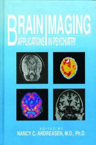 Knjiga Brain Imaging Nancy C. (University of Iowa Hospitals and Clinics ) Andreasen