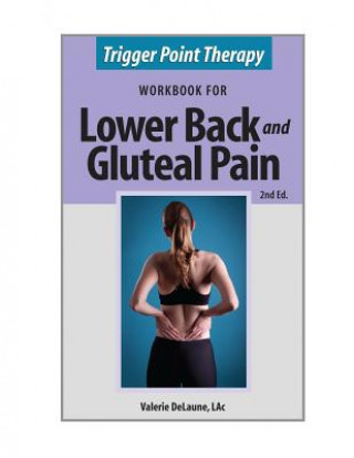Könyv Trigger Point Therapy for Lower Back and Gluteal Pain Valerie Anne Delaune