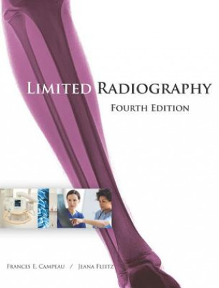 Buch Limited Radiography Frances Campeau