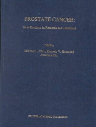 Kniha Prostate Cancer: New Horizons in Research and Treatment Michael L. Cher