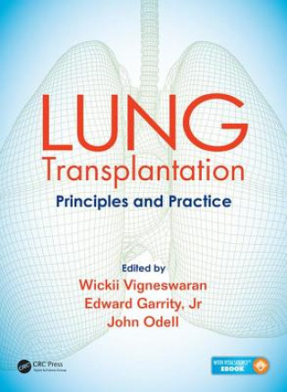 Könyv Lung Transplantation Wickii Vigneswaran