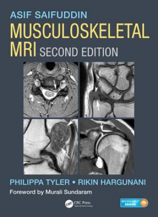 Könyv Musculoskeletal MRI Asif Saifuddin
