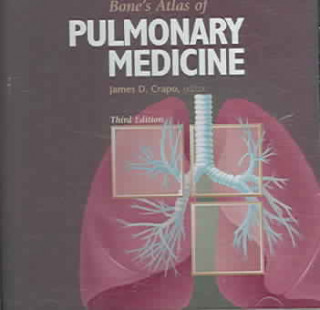 Digitalno Bone's Atlas of Pulmonary Medicine James D. Crapo
