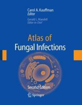 Digital Atlas of Fungal Infection Carol A. Kauffman