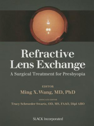 Boek Refractive Lens Exchange Ming X. Wang