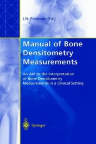 Kniha Manual of Bone Densitometry Measurements John N. Fordham