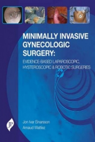 Carte Minimally Invasive Gynecologic Surgery: Evidence-Based Laparoscopic, Hysteroscopic & Robotic Surgeries Jon Ivar Einarsson