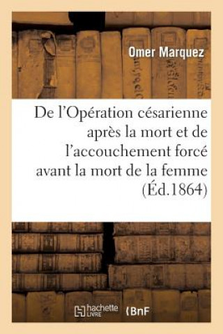 Книга de l'Operation Cesarienne Apres La Mort. de l'Accouchement Force Avant La Mort de la Femme Enceinte Marquez-O