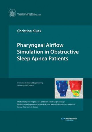 Book Pharyngeal Airflow Simulation in Obstructive Sleep Apnea Patients Christina Kluck