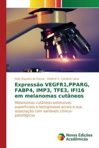 Carte Expressao VEGFR1, PPARG, FABP4, IMP3, TFE3, IFI16 em melanomas cutaneos Siqueira De Souza Kelly
