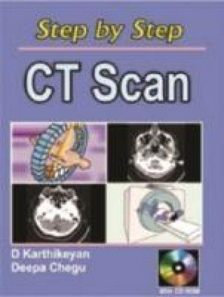 Könyv Step by Step CT Scan Deepa Chegu