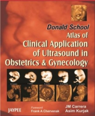 Carte Donald School Atlas of Clinical Application of Ultrasound in Obstetrics & Gynecology J. M. Carrera