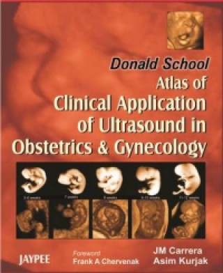 Knjiga Donald School Atlas of Clinical Application of Ultrasound in Obstetrics & Gynecology J. M. Carrera